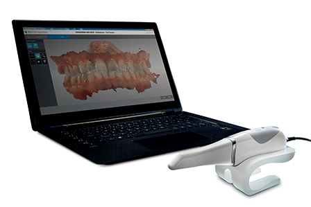 ３D光学スキャナー