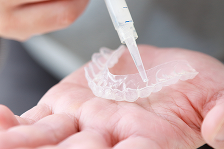 審美歯科・ホワイトニング